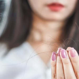 HAIR LOSS